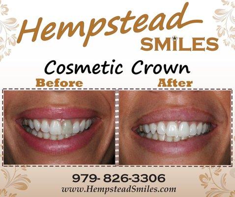 Hempstead Smiles