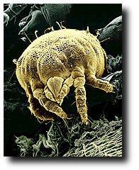 Millions of dust mites and their feces taking up residency in you ducts and carpets.