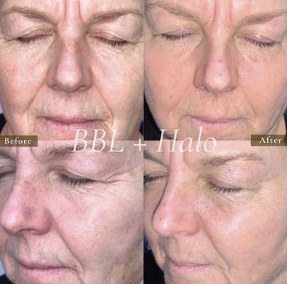 Plump'd Injectables and Beauty Bar