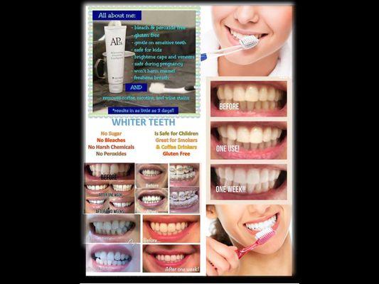 Teeth whitening. Products use at home.