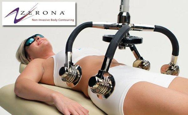 If you are already eating right and exercising but still have stubborn fat, the Zerona can help with those problem areas