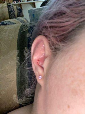 Post removal w/ointment, not a naturally shiny ear. See the nice big hole where the conch was?