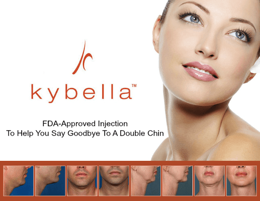 Kybella is a non-surgical injectable for reducing  moderate to severe fat on the upper neck, (double chin). Complimentary consultations!