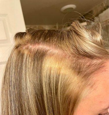 More patches of blonde from the foils bleeding. The bleeding was very obvious and should have been fixed during my appointment