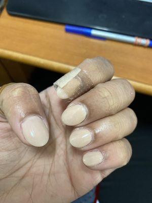 Put a bandaid cause I don't have time to peel it all off. Not just one, but two nails are like this.