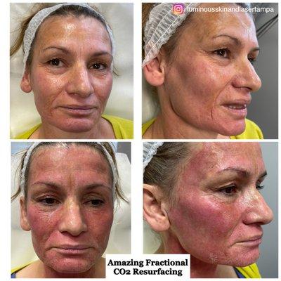 Luminous Skin and Laser 