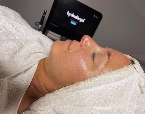 Offering Hydrafacials!