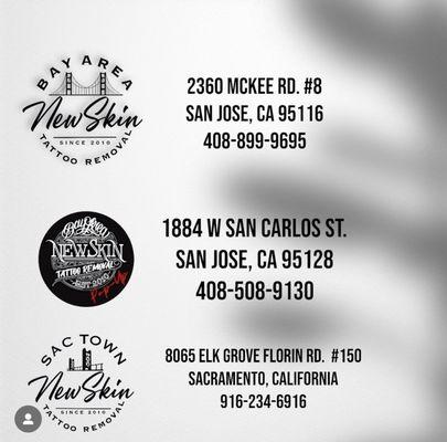 New Skin Tattoo Removal Locations