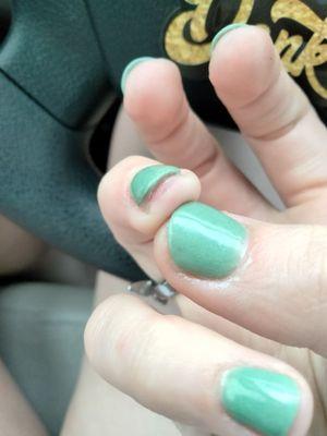 I have literally no nail left and you can see where she cut my finger open with the file underneath where my nail WAS.