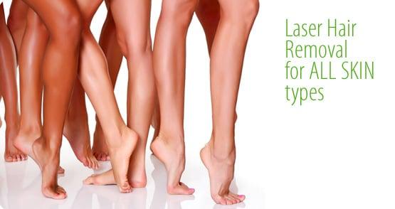 Laser Hair Removal