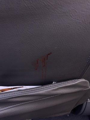 Blood on the back or a first class seat