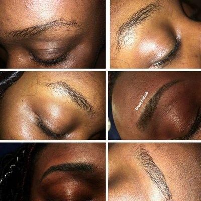 Brow Rehab