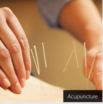 Acupuncture & Wellness Center