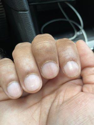 Right hand cuticles (post service)