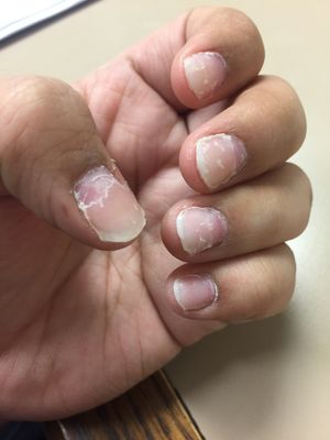 Star Nail