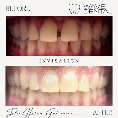 Wave Dental