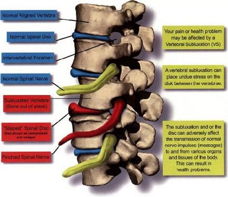 Chiropractic practice explained!