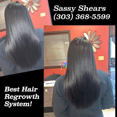 "Best Hair Regrowth System!"