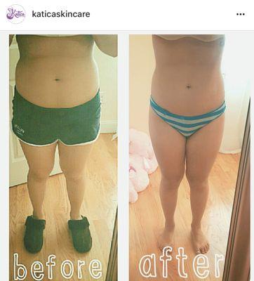 Before & after of our Weight Loss Package