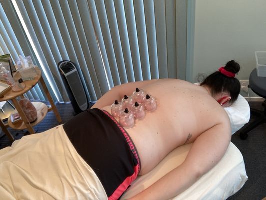 Static cupping.