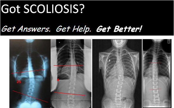 We have patients from around the world who come to our clinic for the most advanced scoliosis exercise based treatments....