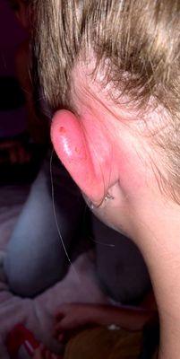 This is her ear after she took it out