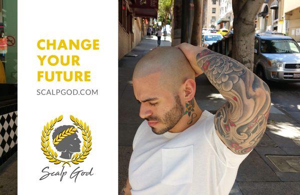 CHANGE YOUR FUTURE!! Hair Restoration Services Available Now!