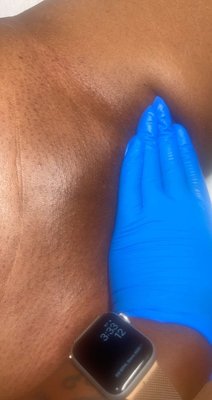 Brazilian Wax