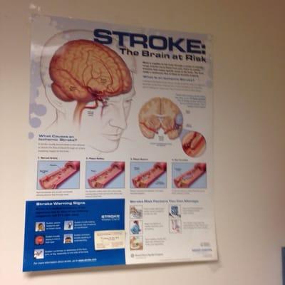 Stroke poster in the waiting room.