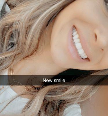 New smile