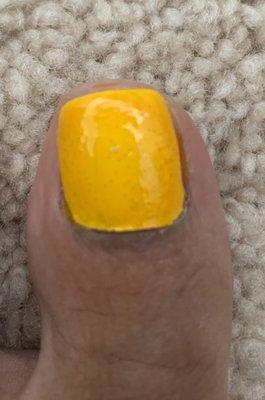 L big toe pedicure