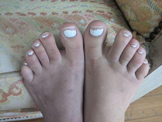 One week after getting the pedicure.