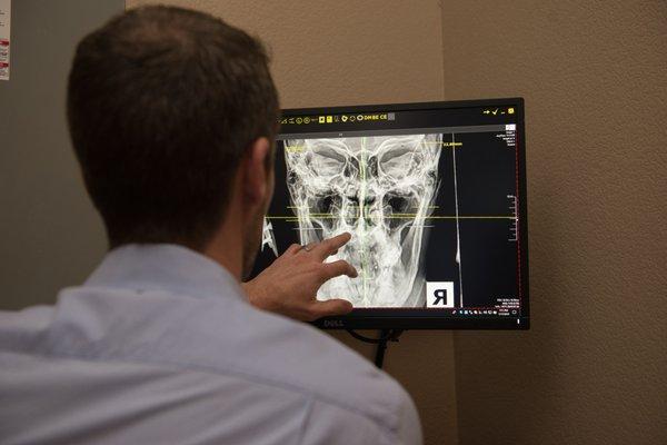 Specialized x-ray imaging used to evaluate head and neck alignment.