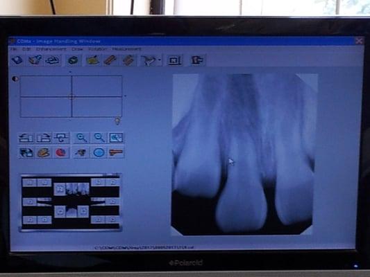 new digital x-ray technology utilized by the office