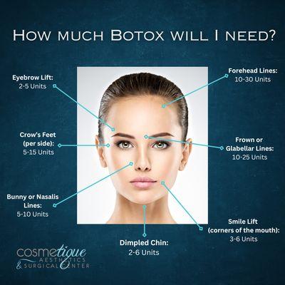 Use this as a guide to see where and how much botulinum toxin is typically used around the face!