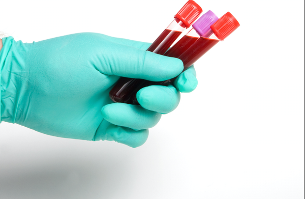 We are highly qualified and motivated mobile phlebotomists that provide superior specimen collection services for clients.