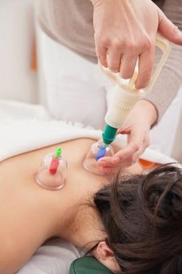 Massage Cupping Therapy