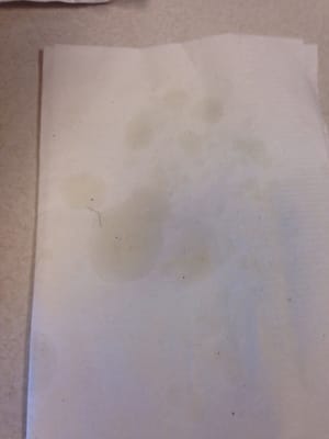 Hair on napkin