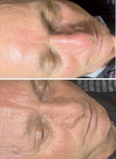 Brightening Facial