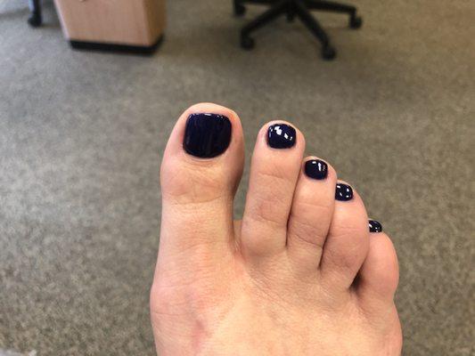 Recent gel pedicure