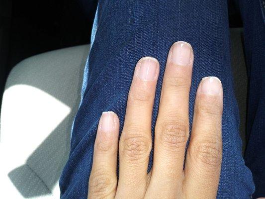 My butchered nails