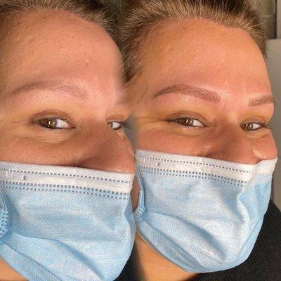 Microblading