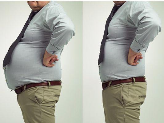 Men's Medical Weight Loss