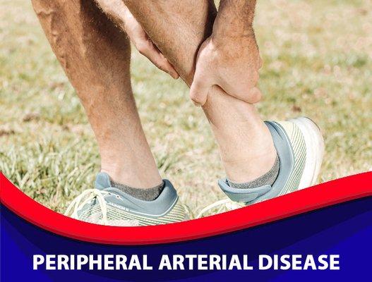 Peripheral Arterial Disease (aka Peripheral Artery Disease or PAD)