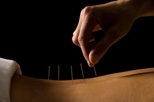 Wellness Medic Acupuncture