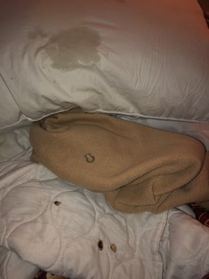 crust on the pillow, cigarette holes.