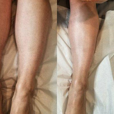 Lower leg wax, 20 minutes or less!