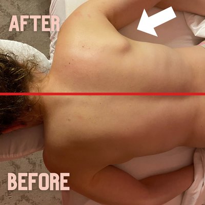 Before and after view. How our techniques correct improper posture. Can you find all the changes?