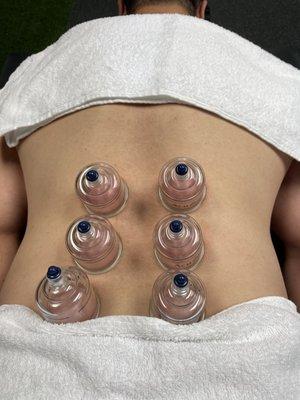 Cupping