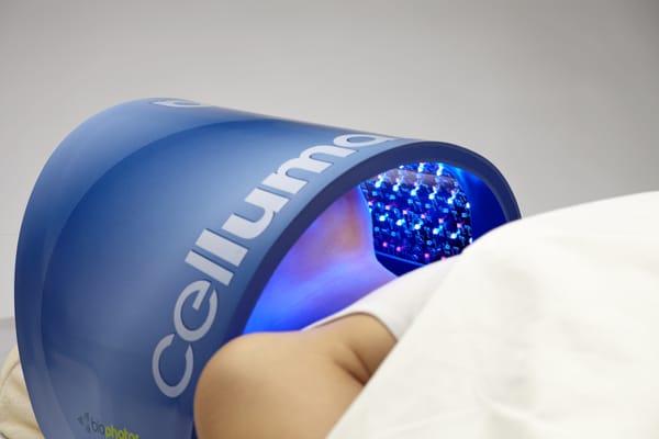 Celia LED treatment to prevent skin agin and for skin rejuvenation with ZERO side effects!